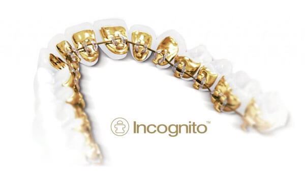 Incognito® logo