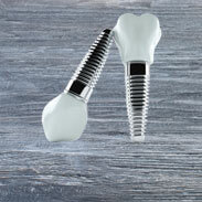 Dental Implants